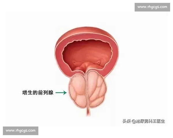 世界小便大赛:谁能在最快时间内完成挑战,争夺尿王称号 世界小便大赛:谁能在最快时间内完成挑战,争夺尿王称号